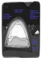 Mama Shot-ime Outdoor Hen / ママショタイム アウトドア編 [Mizuiro Megane] [Original] Thumbnail Page 30