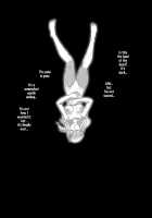 Toubatsu Note Orc Zoku Yousai Hen / 討伐ノート オーク族要塞編 [Yan] [Original] Thumbnail Page 37