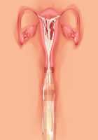 Princess Figline no Yuuga na Sakusei Life ~Uchidome Nante Yurusanai Wa Yo~ / 魔界プリンセスフィリーネの優雅な搾精ライフ～打ち止めなんて許さないわよ～ [Louis And Visee] [Original] Thumbnail Page 100