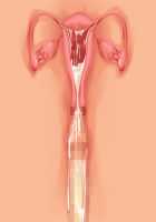 Princess Figline no Yuuga na Sakusei Life ~Uchidome Nante Yurusanai Wa Yo~ / 魔界プリンセスフィリーネの優雅な搾精ライフ～打ち止めなんて許さないわよ～ [Louis And Visee] [Original] Thumbnail Page 99