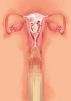 Ore ga ♀ de Kanojo ga ♂ ni!? Kiyowa Bishounen to Kanpeki Bishoujo ga Change! ~Dasanaide! Jibun no Karada de Ninshin Saserarete Icchau!~ / 俺が♀で彼女が♂に!? 気弱美少年と完璧美少女がChange！ ～出さないで！自分のカラダで妊娠させられてイっちゃう！～ [Ayase Hazuki] [Original] Thumbnail Page 104