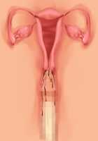 Ore ga ♀ de Kanojo ga ♂ ni!? Kiyowa Bishounen to Kanpeki Bishoujo ga Change! ~Dasanaide! Jibun no Karada de Ninshin Saserarete Icchau!~ / 俺が♀で彼女が♂に!? 気弱美少年と完璧美少女がChange！ ～出さないで！自分のカラダで妊娠させられてイっちゃう！～ [Ayase Hazuki] [Original] Thumbnail Page 141