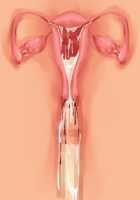 Ore ga ♀ de Kanojo ga ♂ ni!? Kiyowa Bishounen to Kanpeki Bishoujo ga Change! ~Dasanaide! Jibun no Karada de Ninshin Saserarete Icchau!~ / 俺が♀で彼女が♂に!? 気弱美少年と完璧美少女がChange！ ～出さないで！自分のカラダで妊娠させられてイっちゃう！～ [Ayase Hazuki] [Original] Thumbnail Page 144