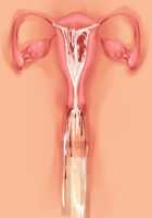 Ore ga ♀ de Kanojo ga ♂ ni!? Kiyowa Bishounen to Kanpeki Bishoujo ga Change! ~Dasanaide! Jibun no Karada de Ninshin Saserarete Icchau!~ / 俺が♀で彼女が♂に!? 気弱美少年と完璧美少女がChange！ ～出さないで！自分のカラダで妊娠させられてイっちゃう！～ [Ayase Hazuki] [Original] Thumbnail Page 145