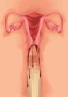 Ore ga ♀ de Kanojo ga ♂ ni!? Kiyowa Bishounen to Kanpeki Bishoujo ga Change! ~Dasanaide! Jibun no Karada de Ninshin Saserarete Icchau!~ / 俺が♀で彼女が♂に!? 気弱美少年と完璧美少女がChange！ ～出さないで！自分のカラダで妊娠させられてイっちゃう！～ [Ayase Hazuki] [Original] Thumbnail Page 146