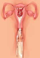 Saikyou no Maou-sama ga Nyotaika!? ~ Hatsujou Yuusha ni Semararemakuru Goku Ero Haramase Quest ~ / 最凶の魔王様が女体化！？ ～発情勇者に迫られまくる極エロ孕ませクエスト～ [Soramoti] [Original] Thumbnail Page 409