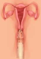 Kemo Ane ~Kemomimi Onee-san o Oyome-san ni Shite Isekai Haramase Slow Life~ / けもあね ～ケモ耳お姉さんをお嫁さんにして異世界孕ませスローライフ～ [Ouji Hiyoko] [Original] Thumbnail Page 130