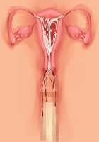 Kemo Ane ~Kemomimi Onee-san o Oyome-san ni Shite Isekai Haramase Slow Life~ / けもあね ～ケモ耳お姉さんをお嫁さんにして異世界孕ませスローライフ～ [Ouji Hiyoko] [Original] Thumbnail Page 131